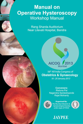Manual On Operative Hysteroscopy Workshop Manual Aicog 2013