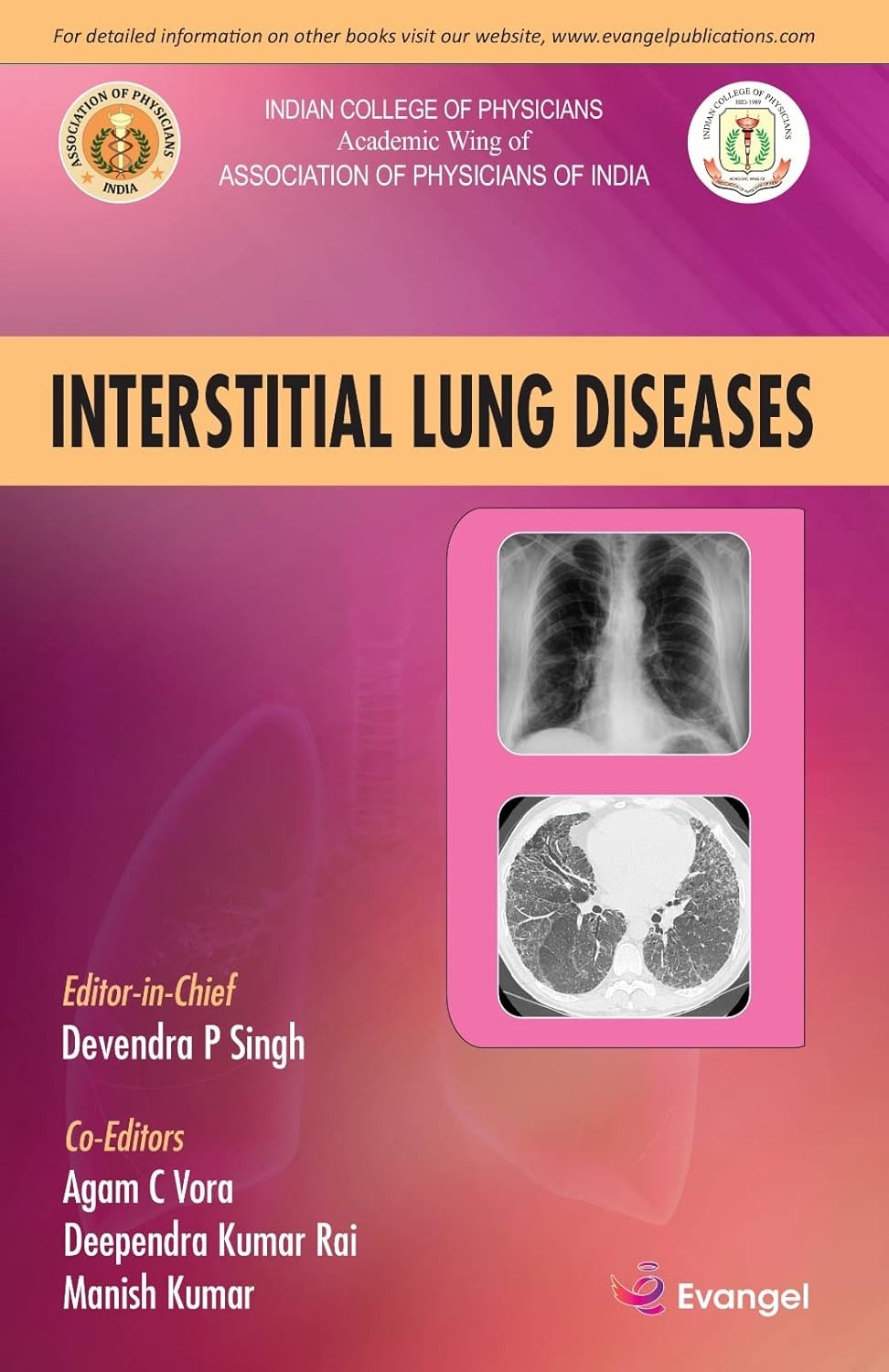 API- ICP-Interstitial Lung Disease