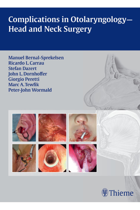 Complications in Otolaryngolgy-Head and Neck Surge 1st Edition 2013