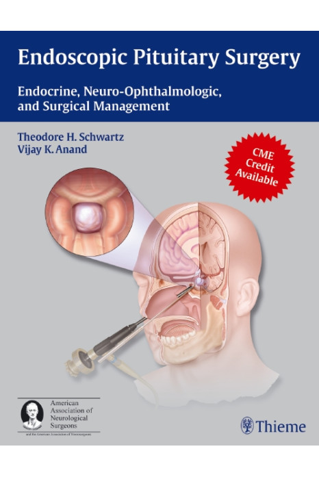Endoscopic Pituitary Surgery 1st Edition 2012