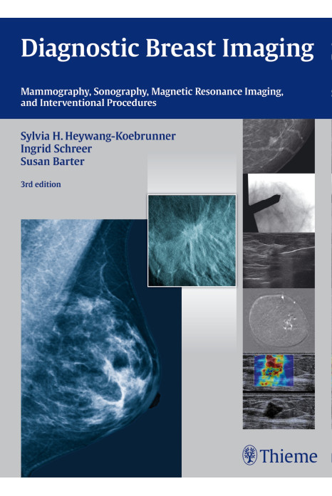 Diagnostic Breast Imaging Mammography, Sonography, Mri And Interventional Procedures