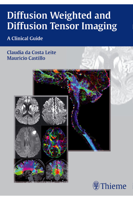 Diffusion Weighted and Diffusion Tensor Imaging A Clinical Guide 1st Edition 2015
