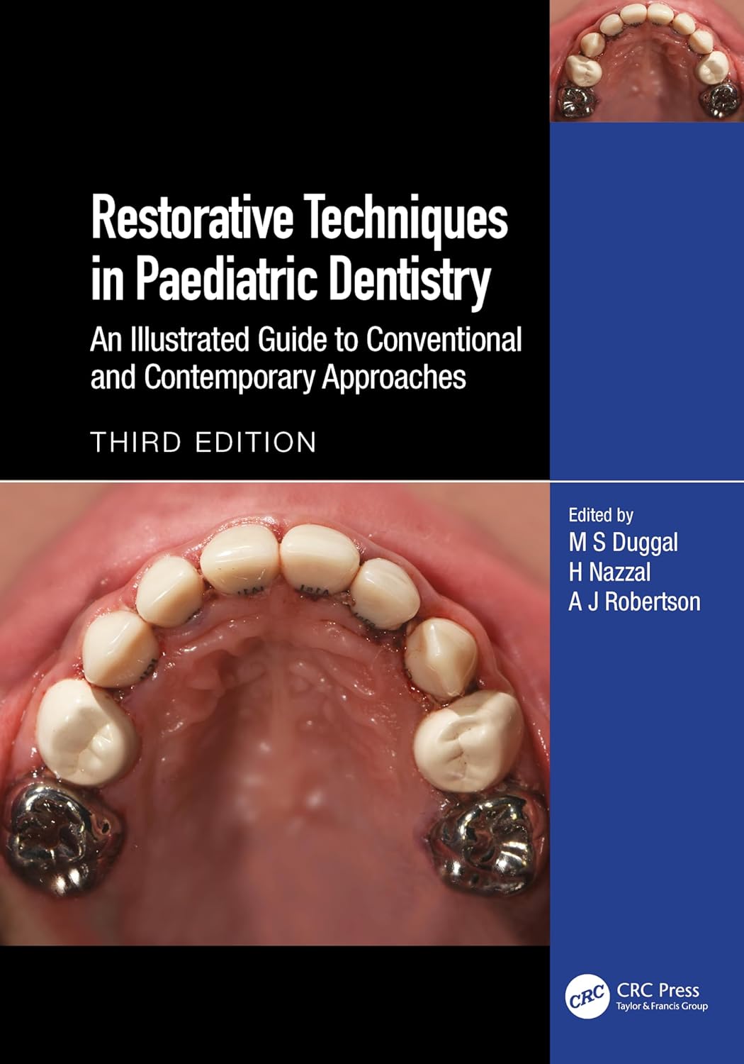 Restorative Techniques In Paediatric Dentistry An Illustrated Guide To Conventional And Contemporary Approaches 3Ed (Hb 2024)