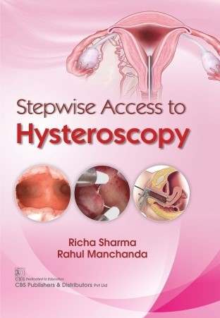 Cover of Stepwise Access To Hysteroscopy