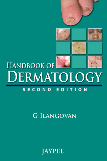 Handbook Of Dermatology