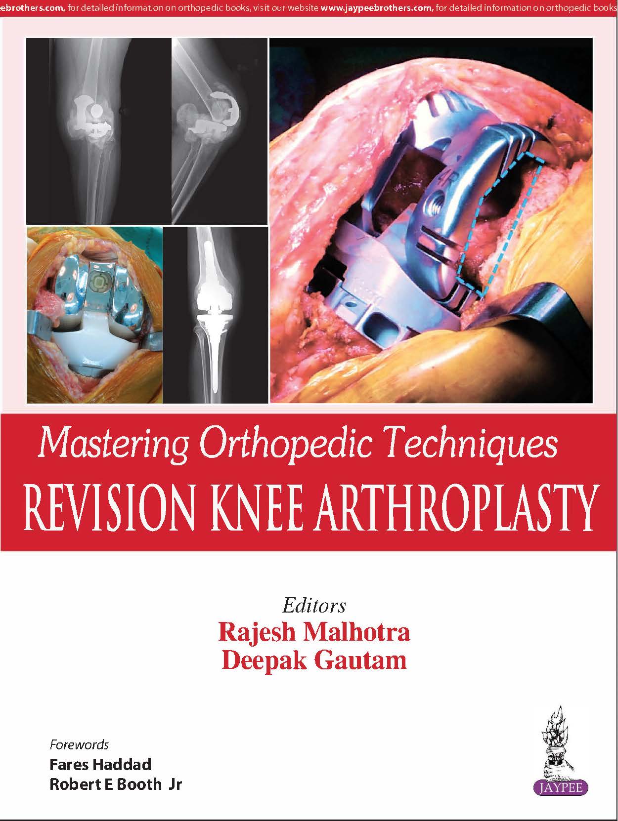 Mastering Orthopedic Techniques Revision Knee Arthroplasty