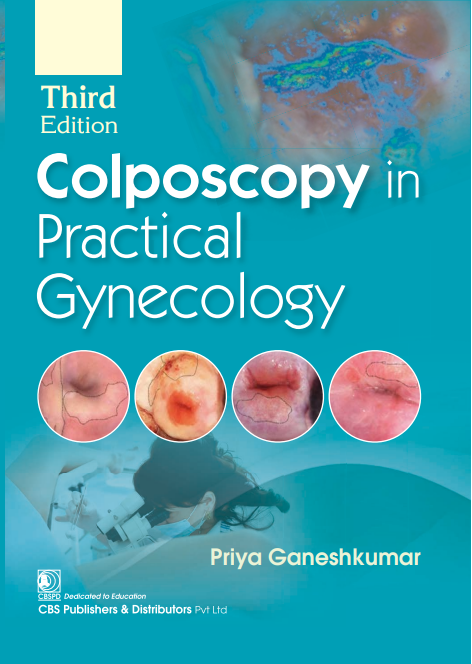 Colposcopy In Practical Gynecology 3Ed (Pb 2025)