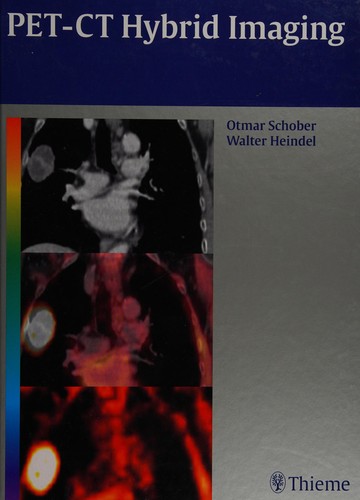 PET-CT hybrid imaging