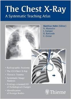 THE CHEST X-RAY (Asian Edition) 2nd Edition 2007