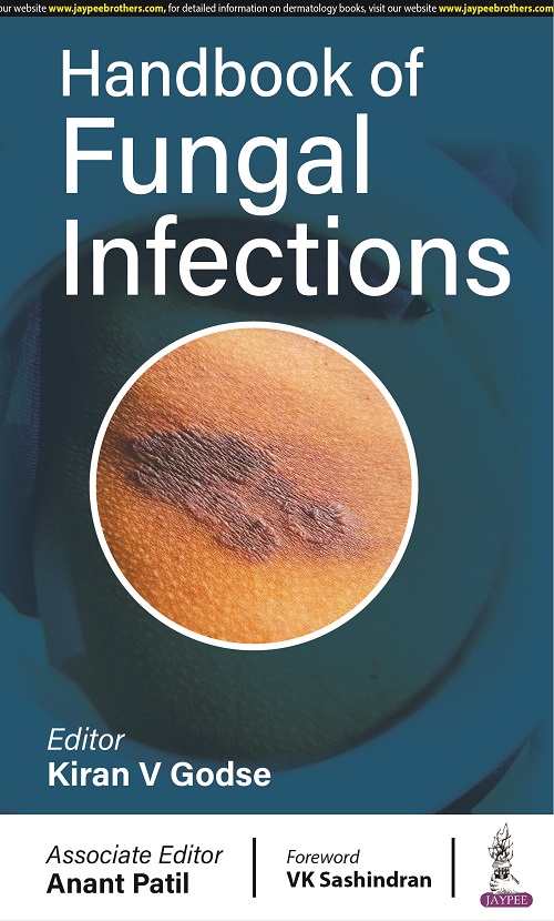 HANDBOOK OF FUNGAL INFECTIONS 1ST EDITION 2023