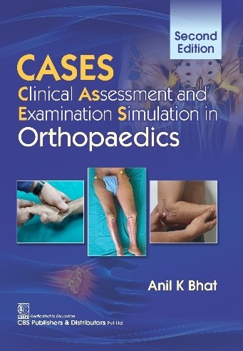 Cases Clinical Assessment And Examination Simulation In Orthopaedics 2Ed (Pb 2024)