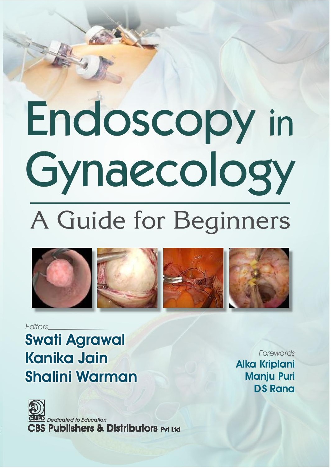 Endoscopy In Gynaecology A Guide For Beginners (Pb 2025)