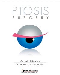 Ptosis Surgery
