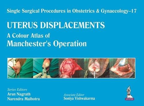 Single Surgical Procedures in Obstetrics and Gynaecology - 17 - UTERUS DISPLACEMENTS: A Colour Atlas of Manchester's Operation