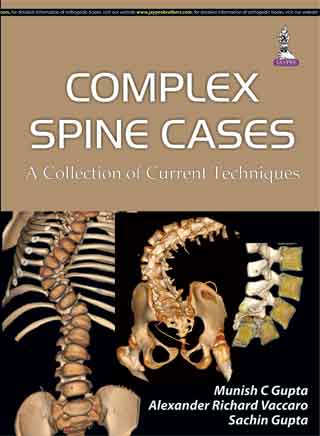 Complex Spine Cases