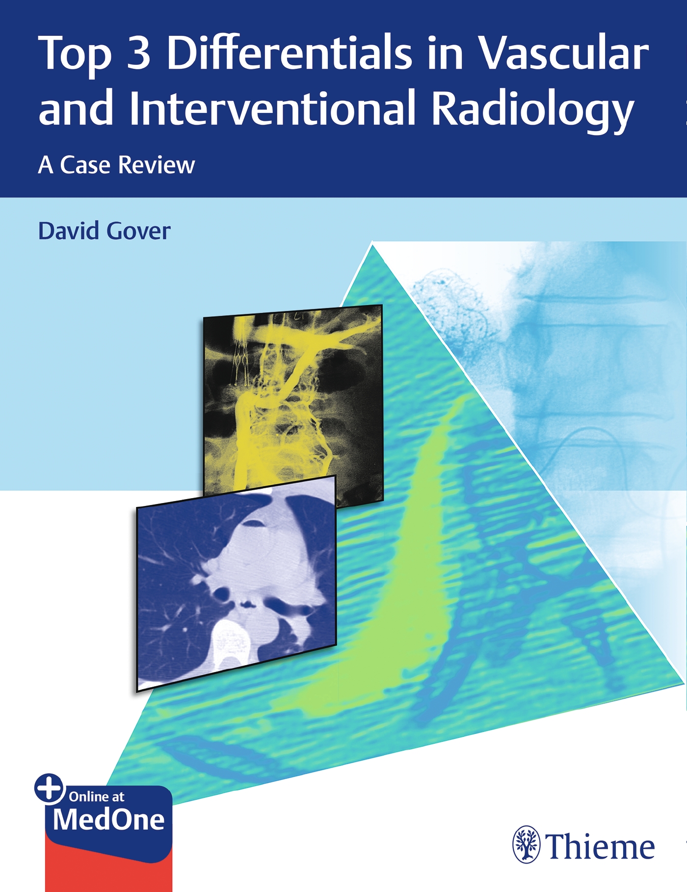 Top 3 Differentials In Vascular And Interventional Radiology A Case Review