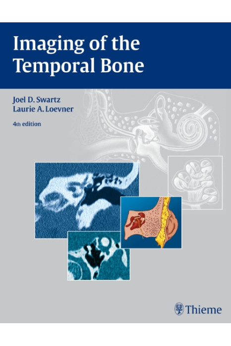 Imaging of the Temporal Bone 4th Edition 2008