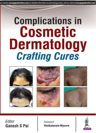 Complications In Cosmetic Dermatology - Crafting Cures