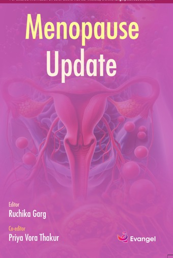 Menopause Update