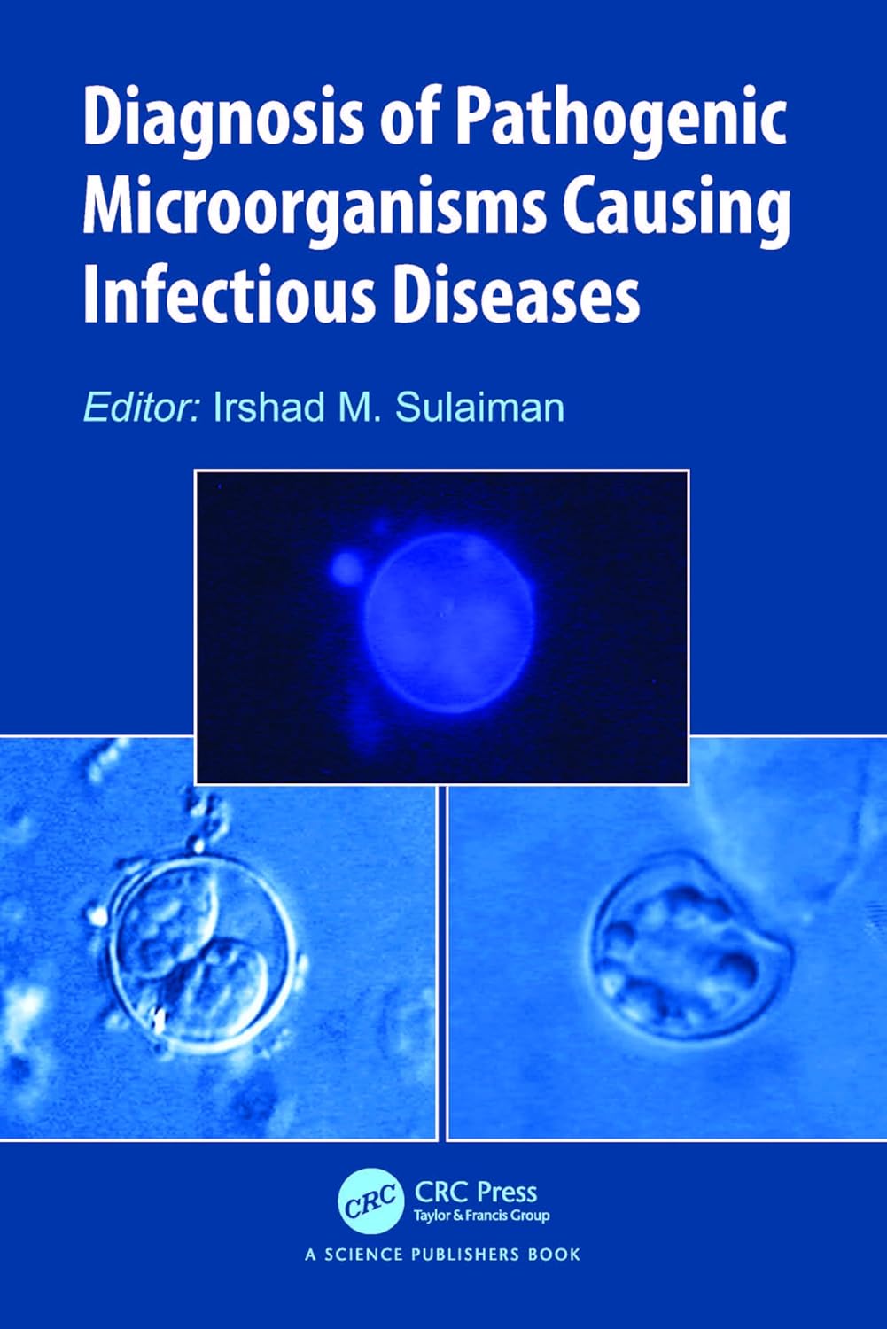 Diagnosis Of Pathogenic Microorganisms Causing Infectious Diseases (Pb 2024)