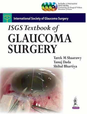 Isgs Textbook Of Glaucoma Surgery Includes 3 Int.Dvd-Roms(International Society Of Glaucoma Surgery)