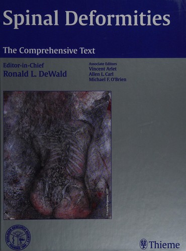 Spinal Deformities: The Comprehensive Text