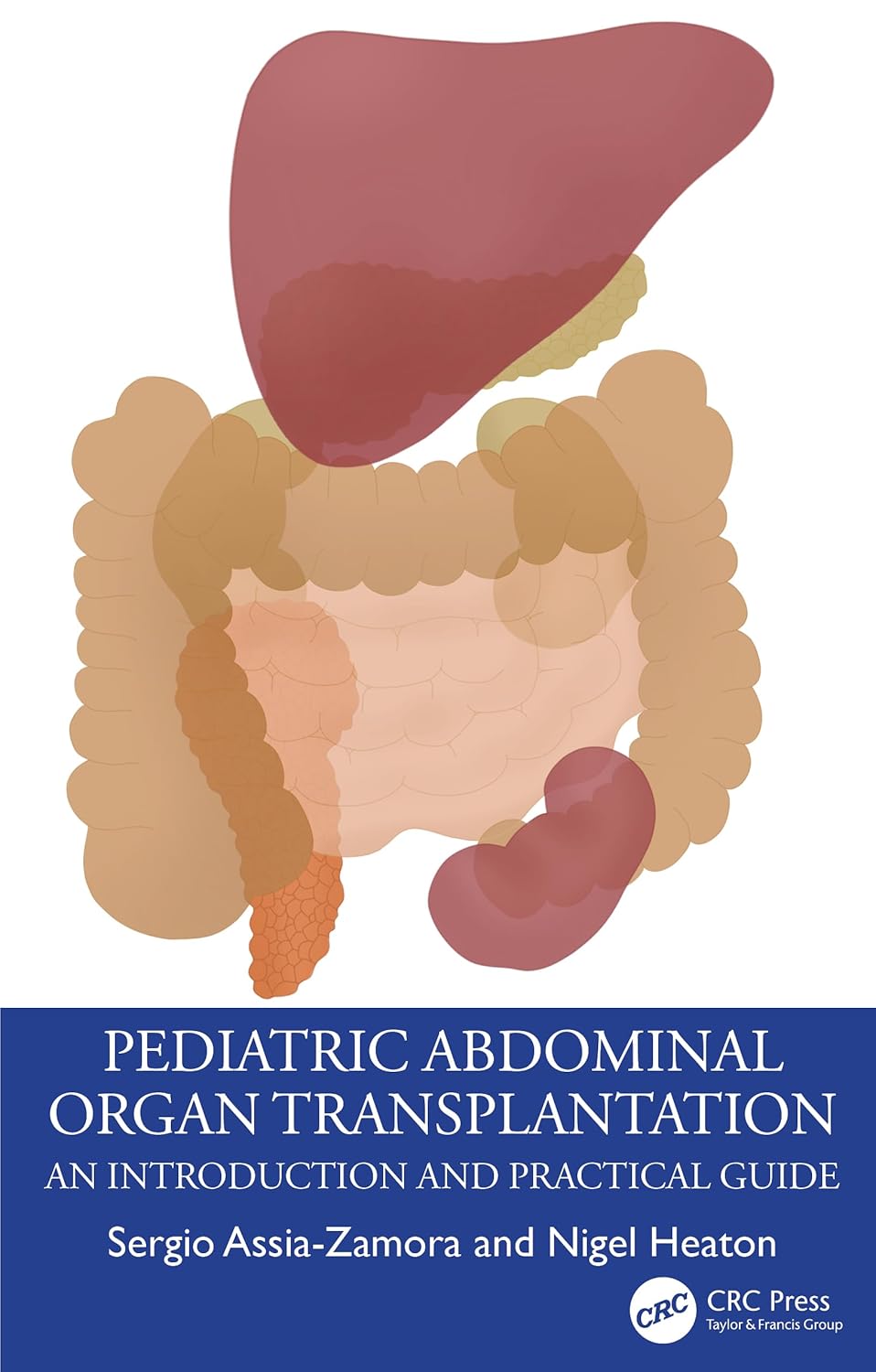 Pediatric Abdominal Organ Transplantation An Introduction And Practical Guide (Pb 2024)