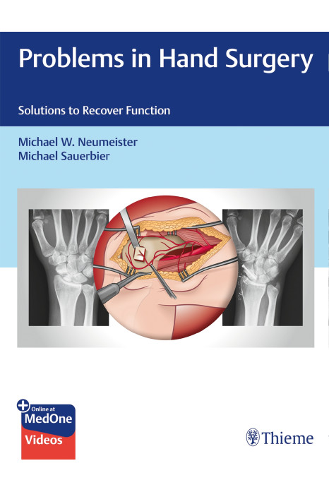 Problems In Hand Surgery Solutions To Recover Function