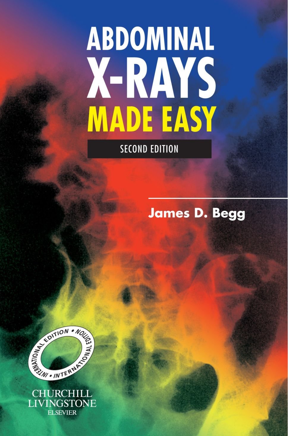 ABDOMINAL X-RAY MADE EASY(INT.ED)