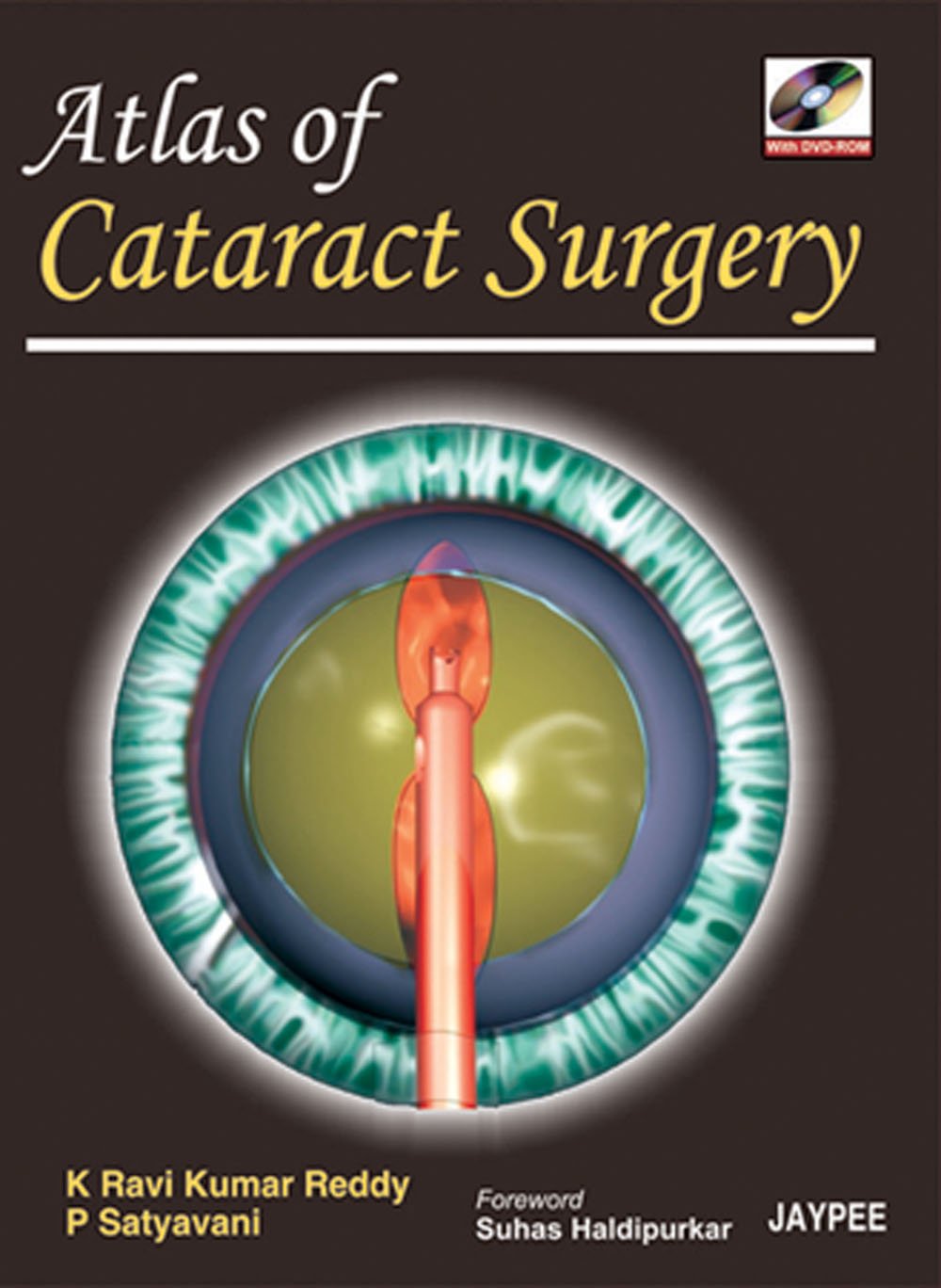 Atlas Of Cataract Surgery With Dvd Rom