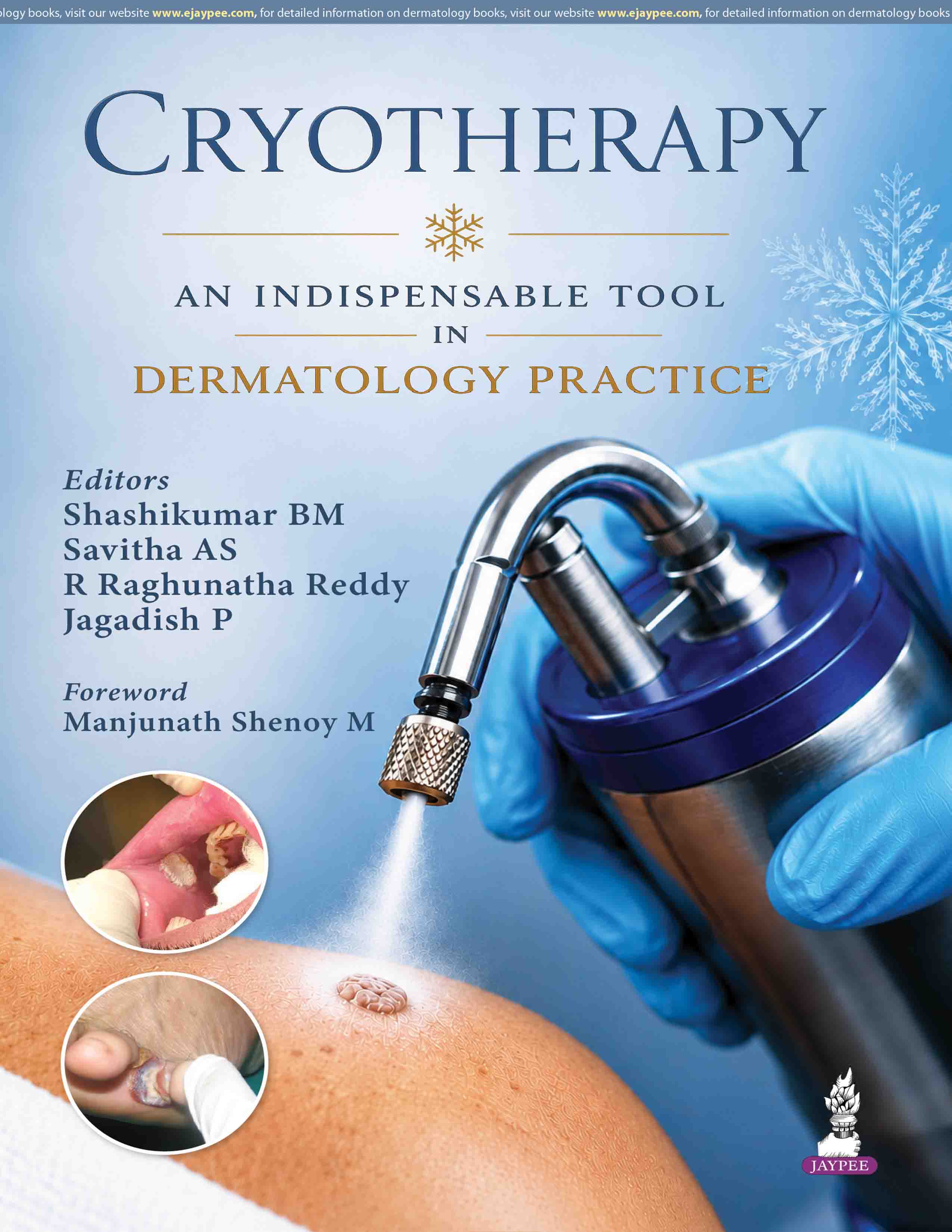 CRYOTHERAPY AN INDISPENSABLE TOOL IN DERMATOLOGY PRACTICE