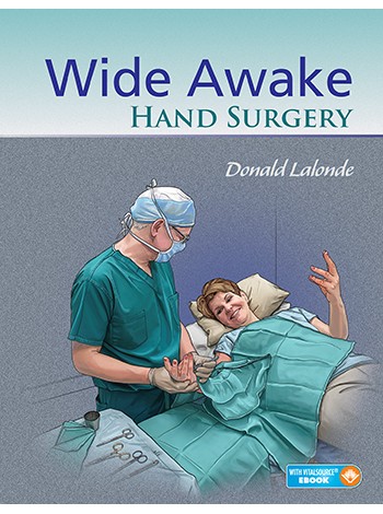 Wide Awake Hand Surgery (Pb 2016)