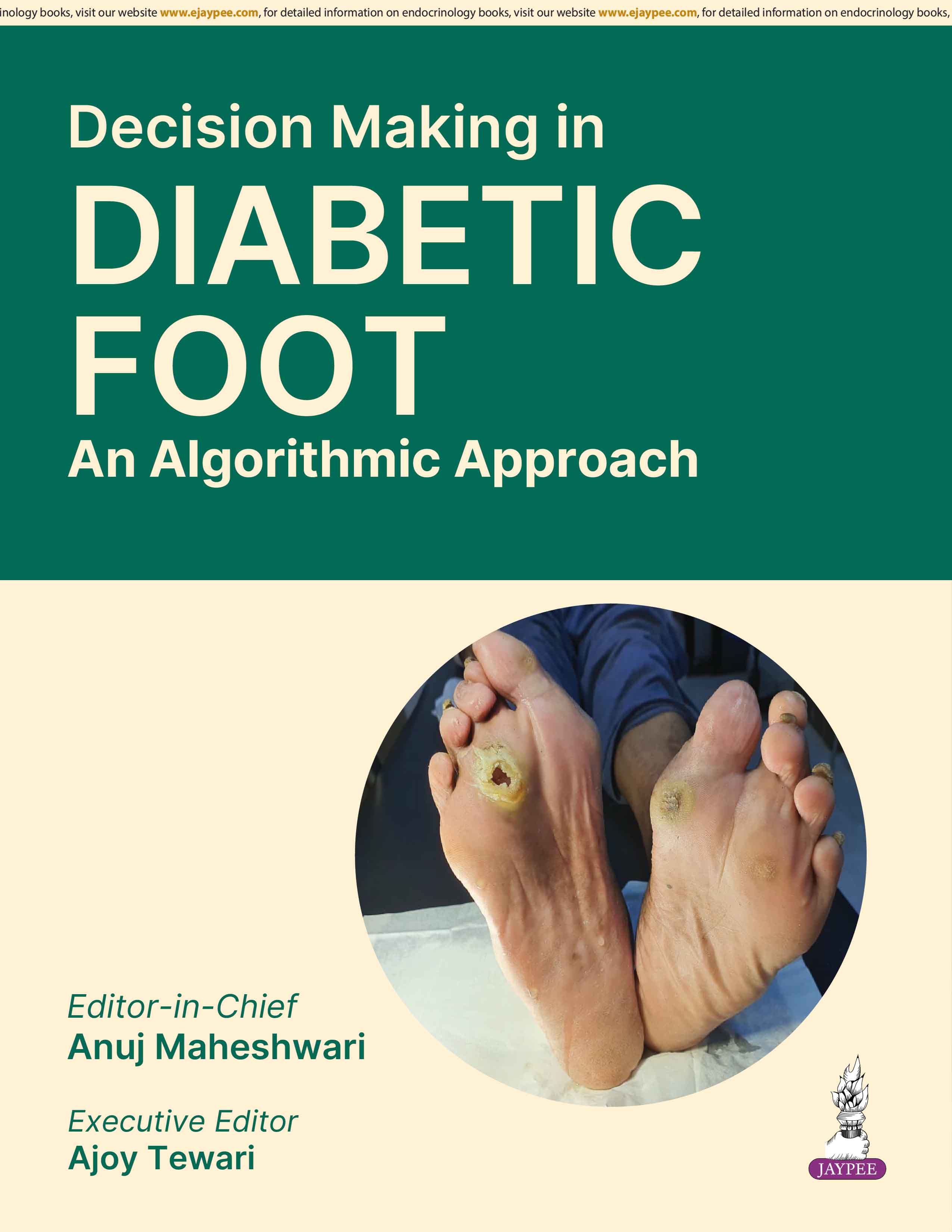 DECISION MAKING IN DIABETIC FOOT AN ALGORITHMIC APPROACH