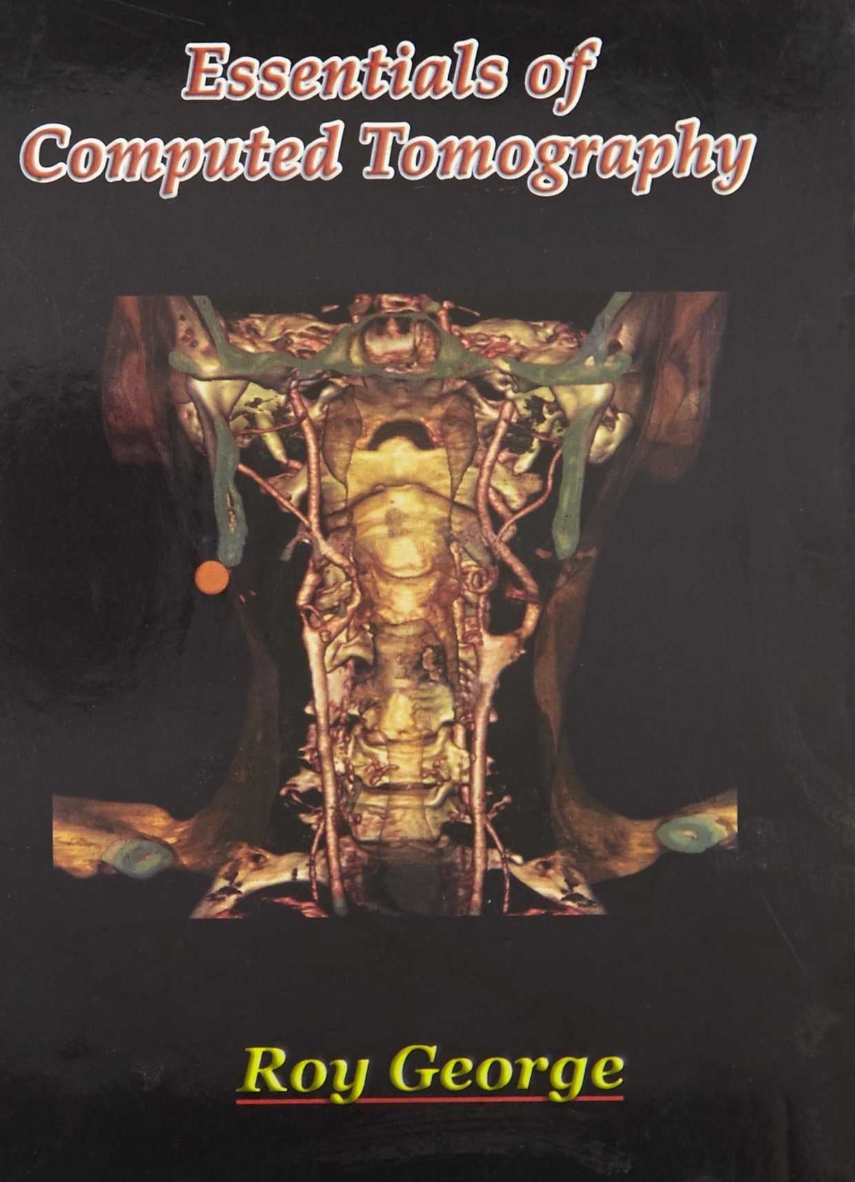 Essentials Of Computed Tomography 1ST EDITION 2008