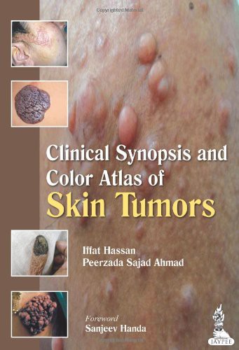 Clinical Synopsis and Color Atlas of Skin Tumors