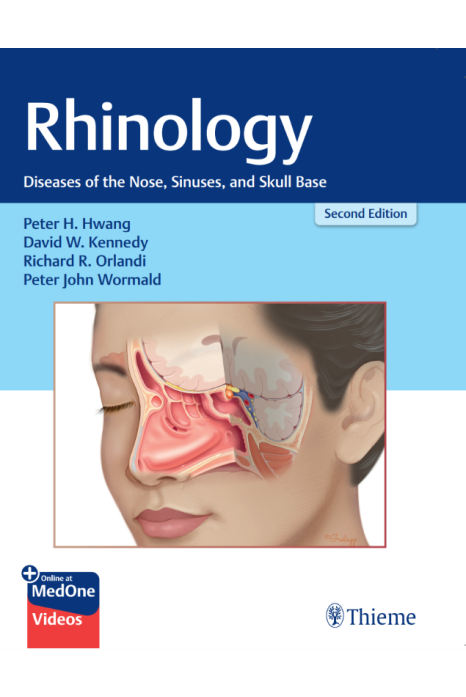Rhinology Diseases Of The Nose, Sinuses, And Skull Base