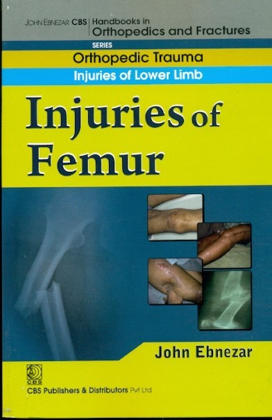 In Juries Of Femur (Handbook In Orthopedics And Fractures Vol 14 Orthopedic Trauma Injuries Of Lower Limb (2012)