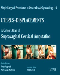 Uterus-Displacements 16,A.C.A Of Supravaginal Cervical Amputation:Single Surg.Proced In Obs&Gyne