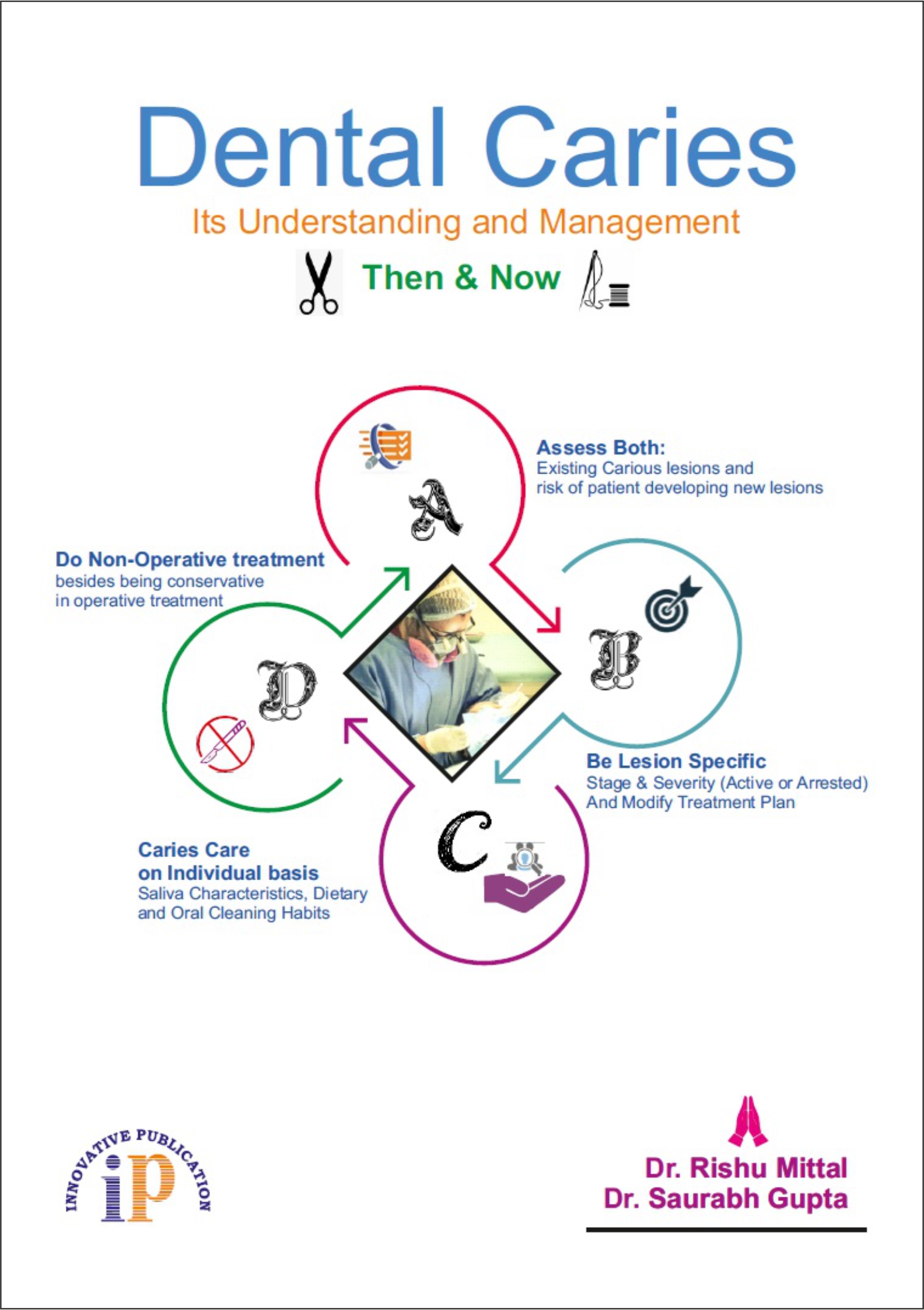 Dental Caries (Its Understanding And Management) Then & Now