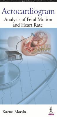 Actocardiogram: Analysis of Fetal Motion and Heart Rate