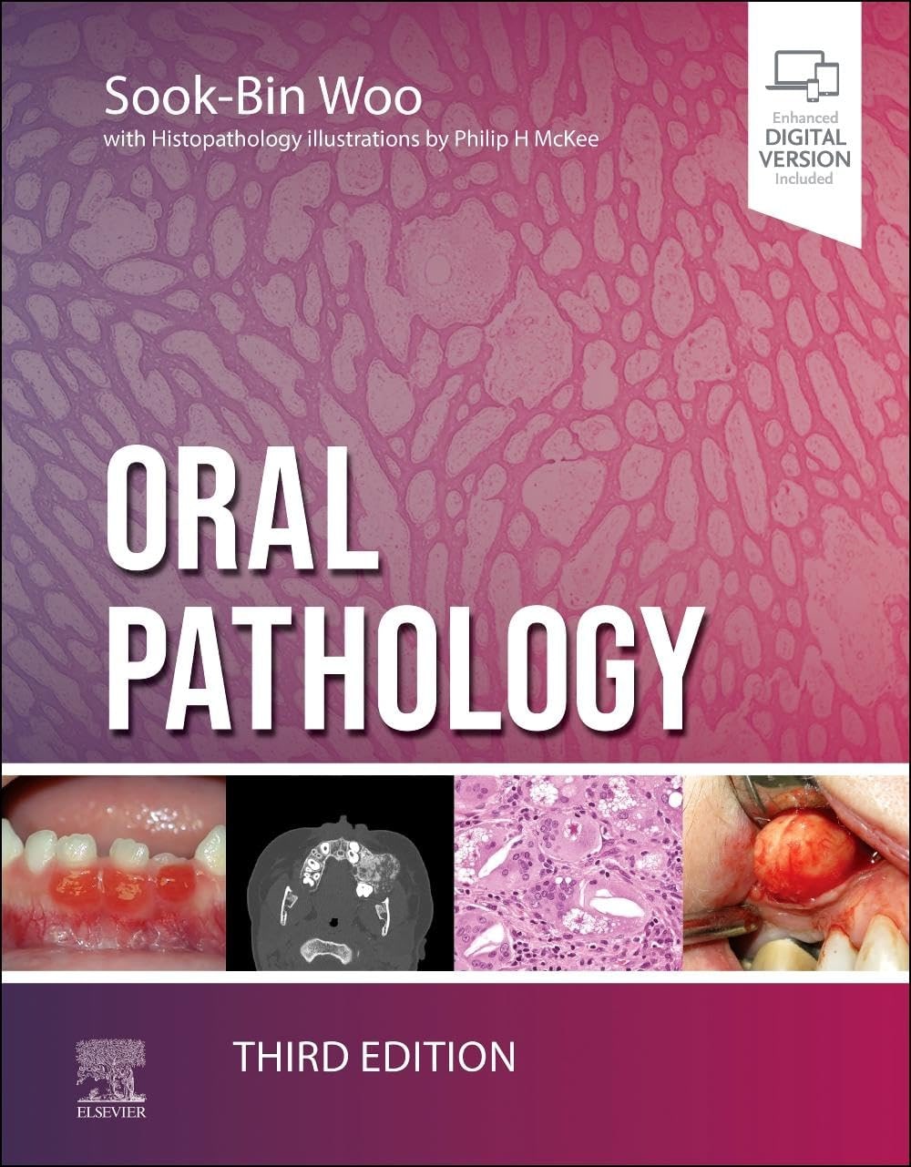 Oral pathology with access code 3ed (hb 2024)