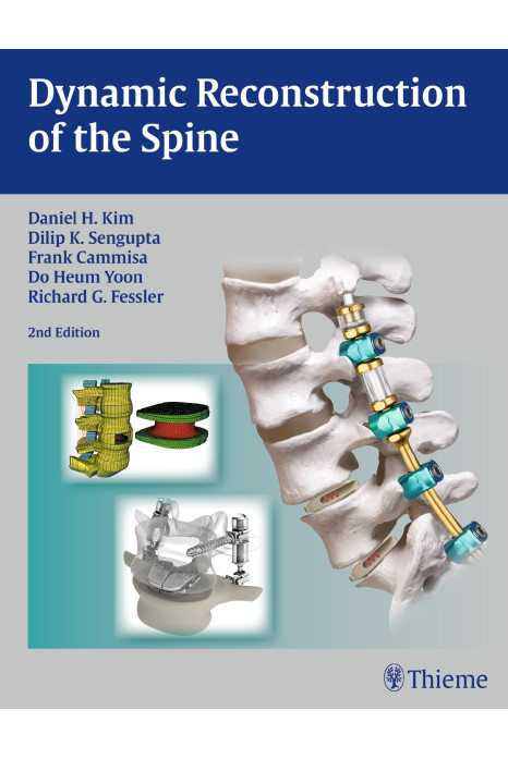 Dynamic Reconstruction Of The Spine 2Ed (Hb 2015)