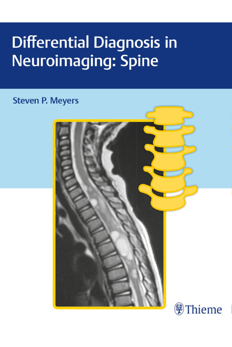 Differential Diagnosis in Neuroimaging Spine 1st Edition 2017
