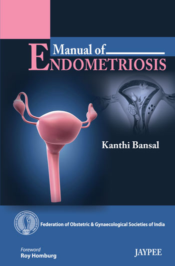 Manual Of Endometriosis