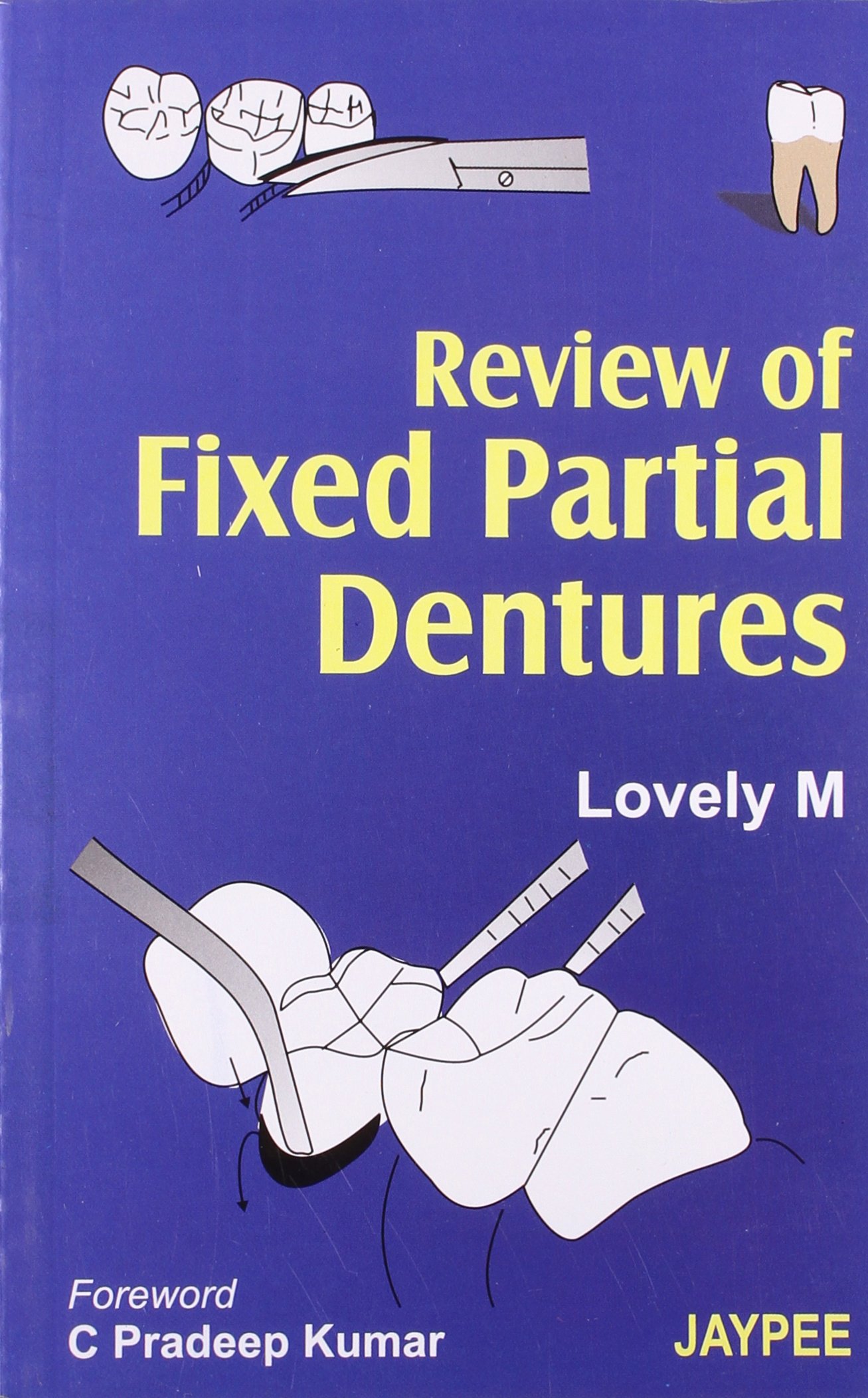 Cover of REVIEW OF FIXED PARTIAL DENTURES
