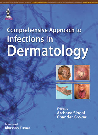 Comprehensive Approach To Infections In Dermatology