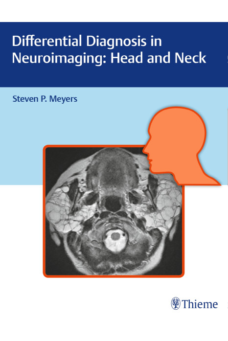 Differential Diagnosis in Neuroimaging Head and Neck 1st Edition 2016