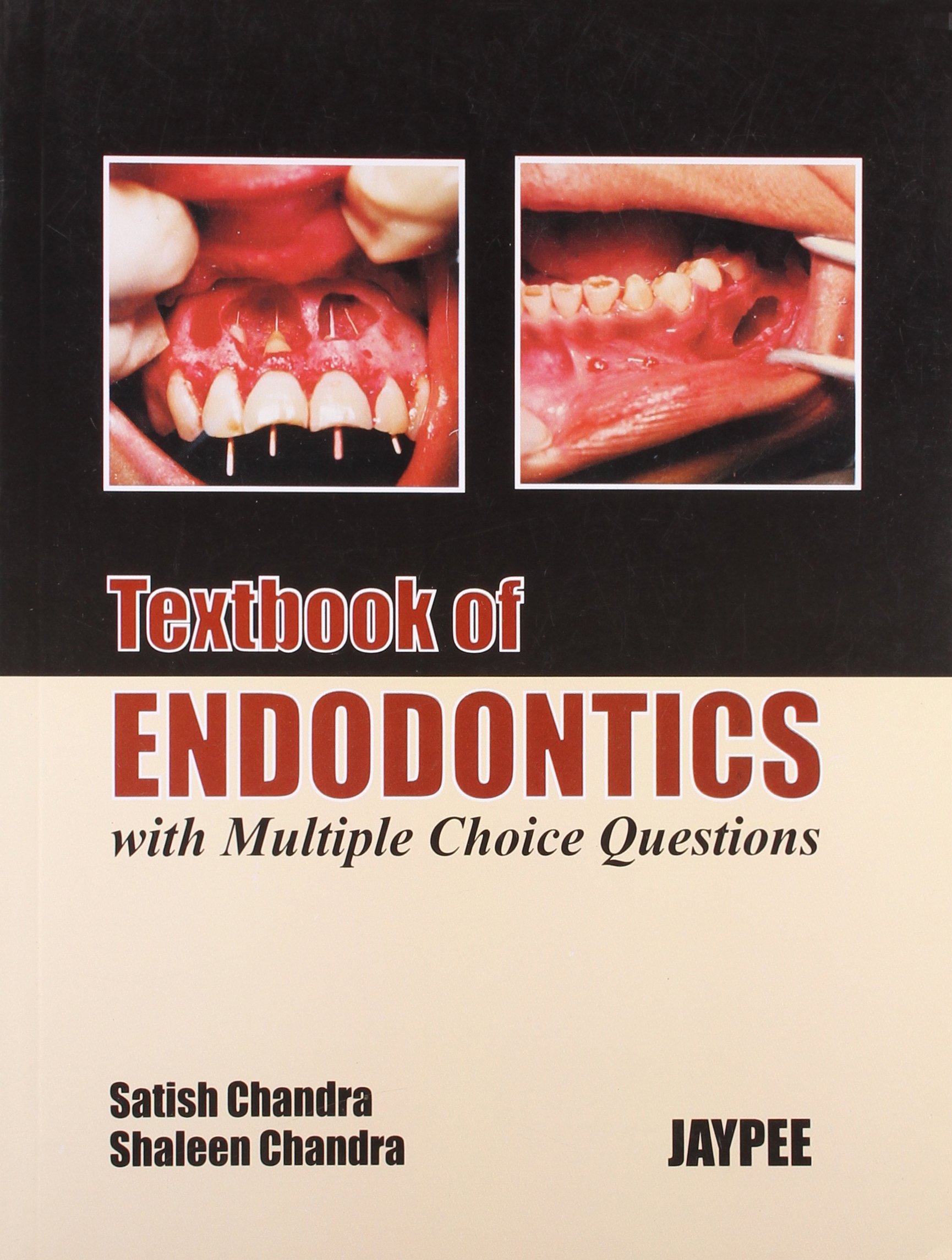 Cover of TEXTBOOK OF ENDODONTICS WITH M.C.QS