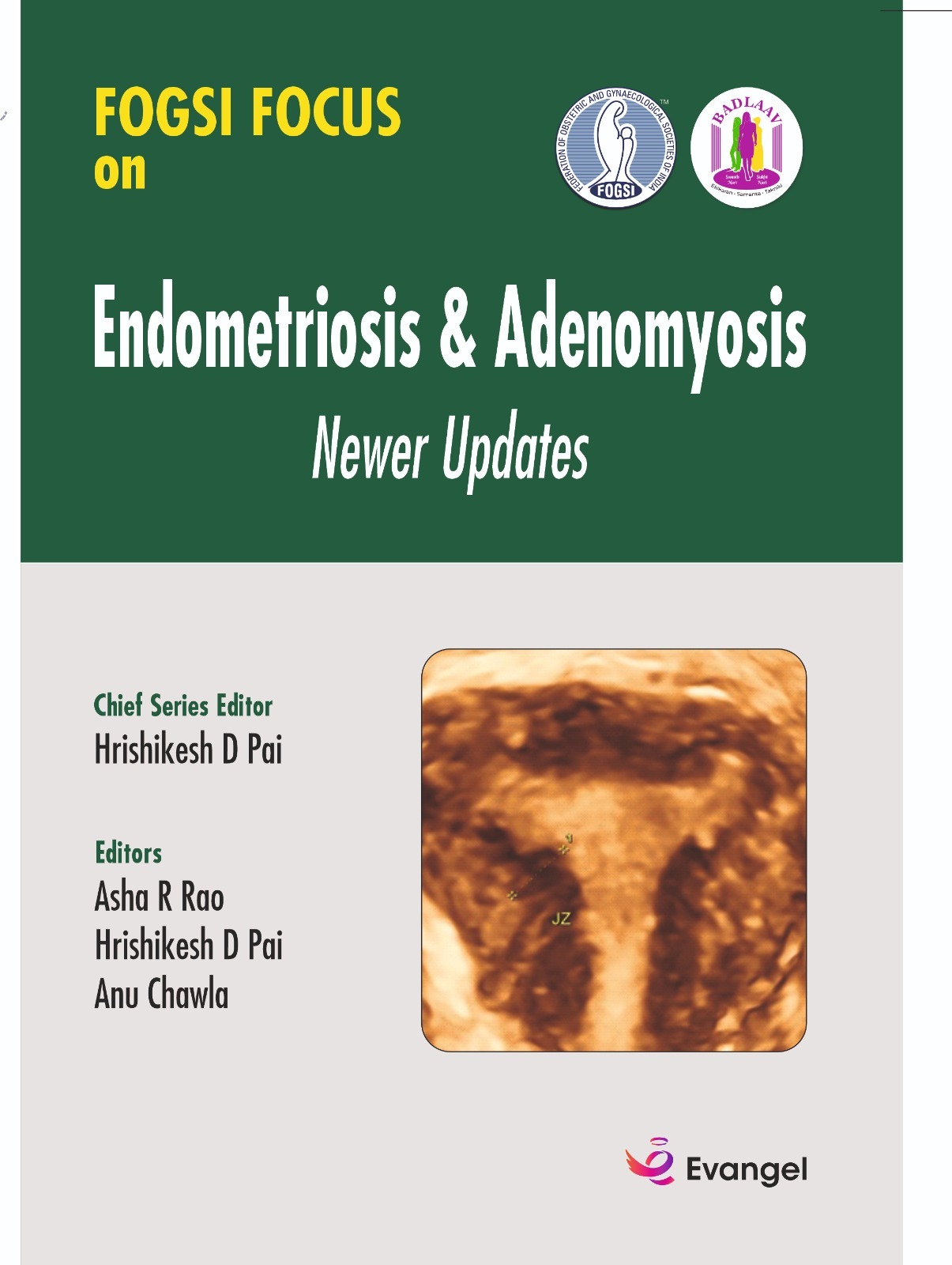 FOGSI FOCUS on Endometriosis & Adenomyosis