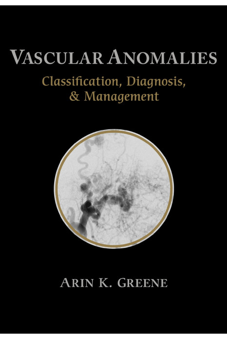 Vascular Anomalies Classification, Diagnosis, And Management